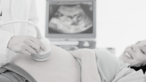 Women receiving a pregnancy ultrasound
